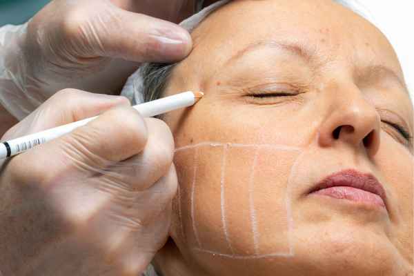 CryoPen: 5 Skin Concerns It May Be Used to Treat 4 What should you ask before having CryoPen treatment Northamptonshire?
